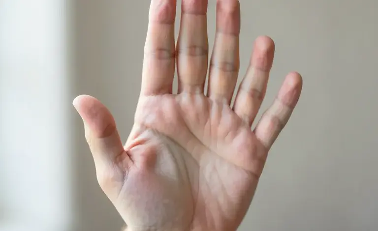 Jak se vyrovnat s body shamingem a urážkami - ilustrační foto