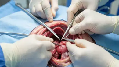 Jak probíhá vaginální hysterektomie a její výhody - ilustrační foto