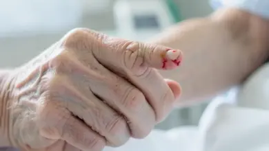 co je hemofilie a jak ji léčit - Co je hemofilie a - ilustrační foto