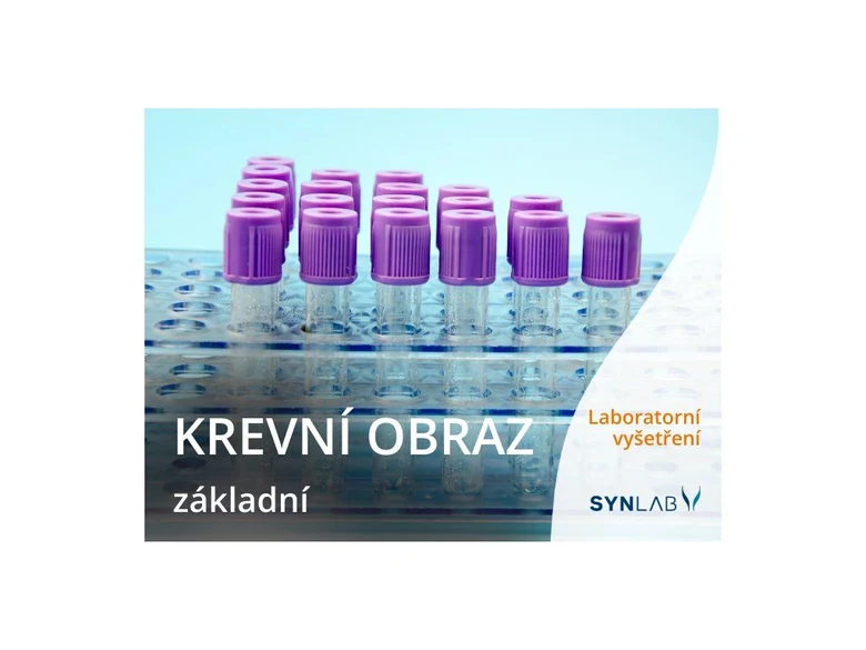 Fialové zkumavky s krví na laboratorním stojanu pro krevní obraz.