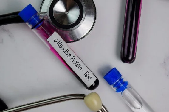 Crp test tube and stethoscope