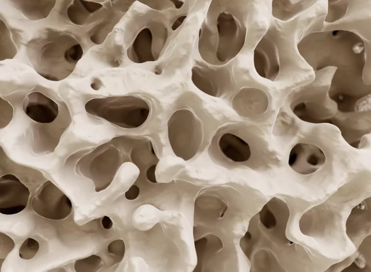 Bone trabecular structure