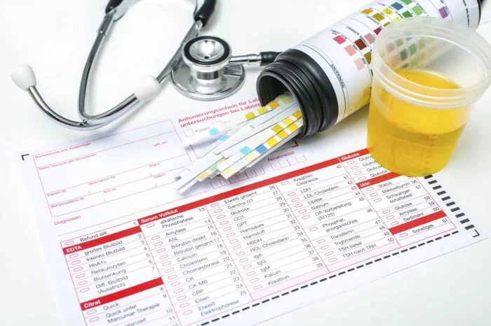 Krevní odběr, močový vzorek a lékařské vybavení pro diagnostiku.