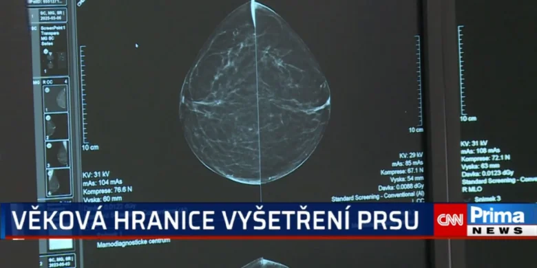 Mammogramová snímka prsu na lékařském displeji.
