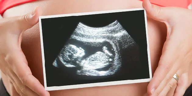 Těhotná žena drží ultrazvukový snímek s plodem na břiše.
