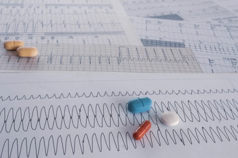 EKG papíry s různými léky na léčbu srdeční arytmie