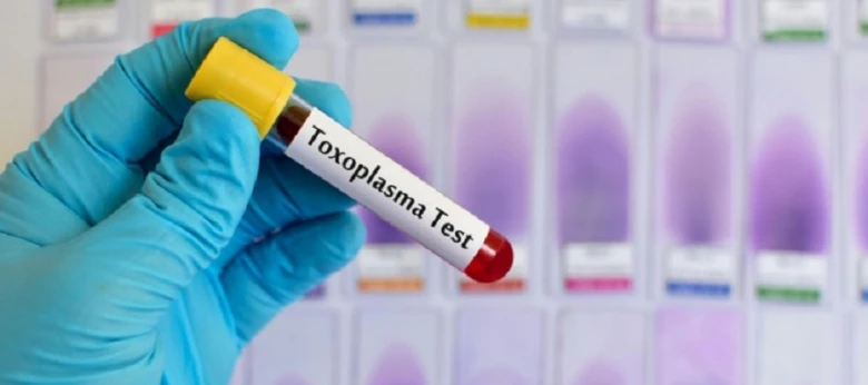 Ruka drží zkumavku s krví pro toxoplazmózu.