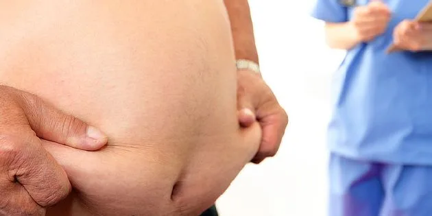 Zobrazení měření kožního skluzu na břiše u obezity.