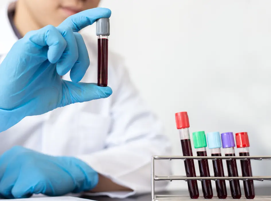 Ruce drží zkumavku s krví obsahující červené krvinky pro laboratorní analýzu.