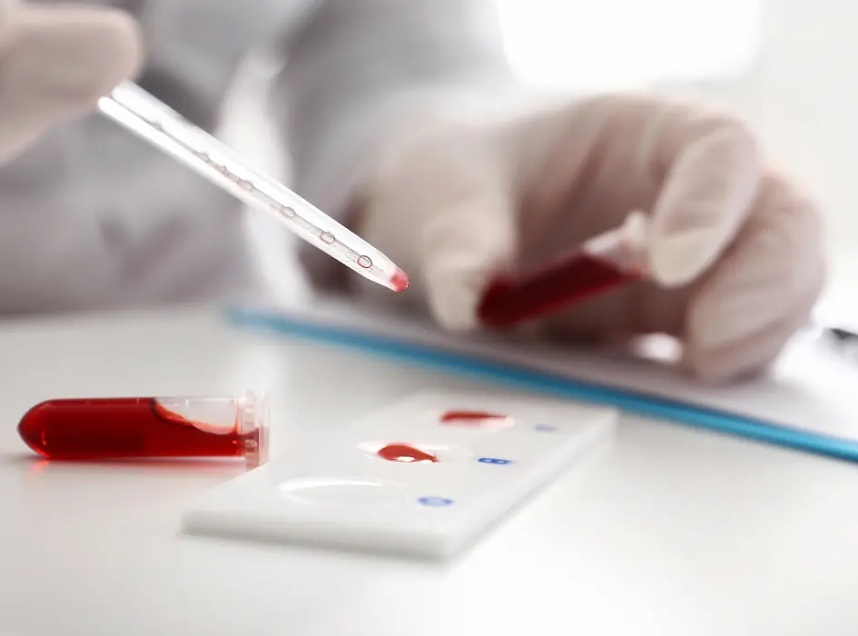 Krevní vzorek s červenými krvinkami pro laboratorní test.
