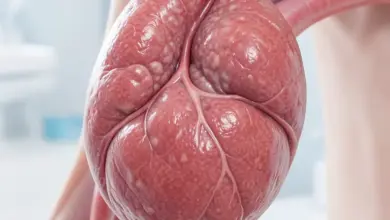 co je struma nodosa příznaky a léčba - Co je struma nodosa - ilustrační foto