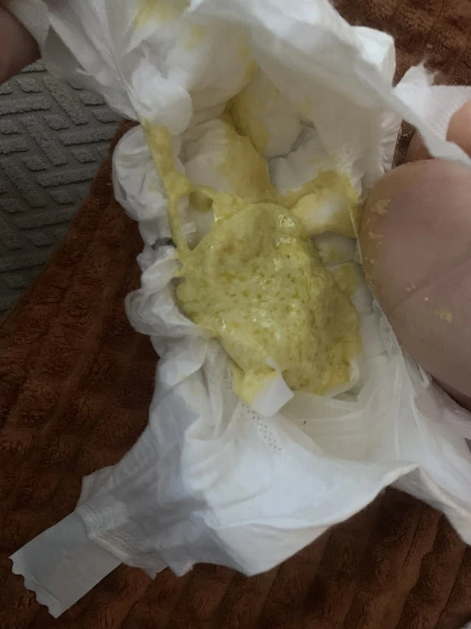 Žlutá stolice novorozence v plenkách na hnědém povrchu.