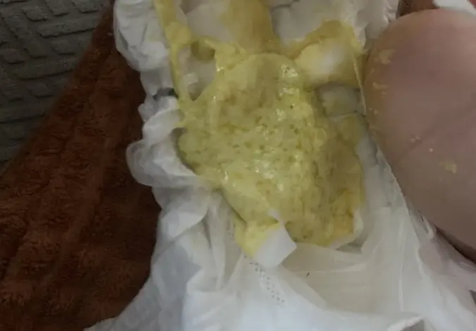 Světlá stolice dítěte v plenkách na hnědé utěrce.