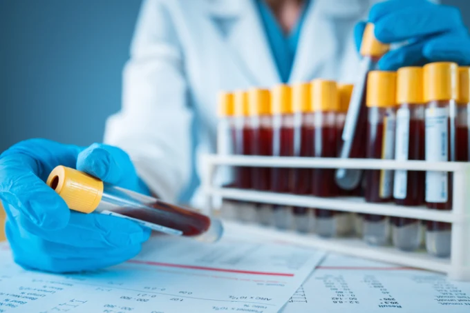 Laborant drží krevní vzorek v testovací trubicí vedle stojanu.