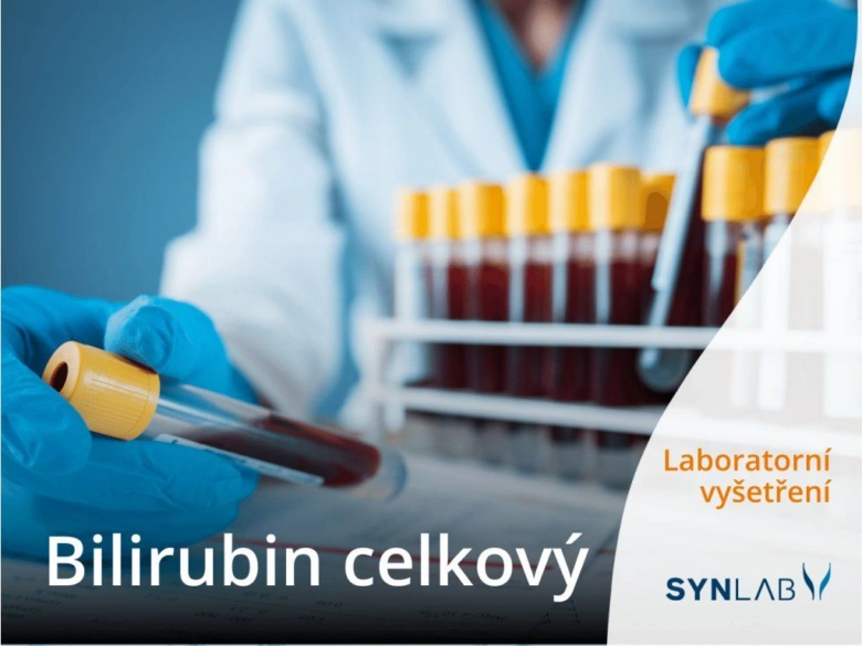 Laborant drží zkumavky s krví pro vyšetření celkového bilirubinu.