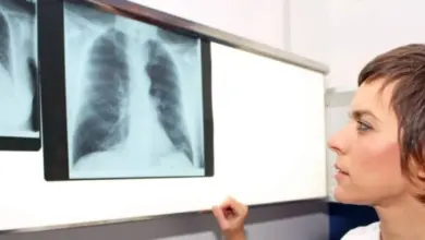 Lékařka zkoumá rentgenové snímky plic v nemocničním prostředí.