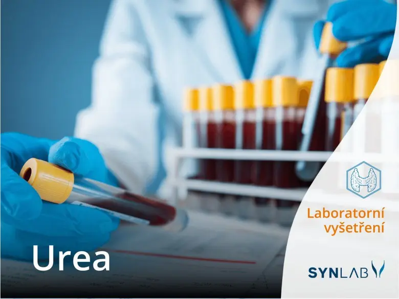 Laborant drží krevní vzorek pro testování urey v laboratoři.