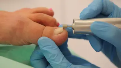 Lékař upravuje zarůstající nehet na palci elektrickým pilníkem.