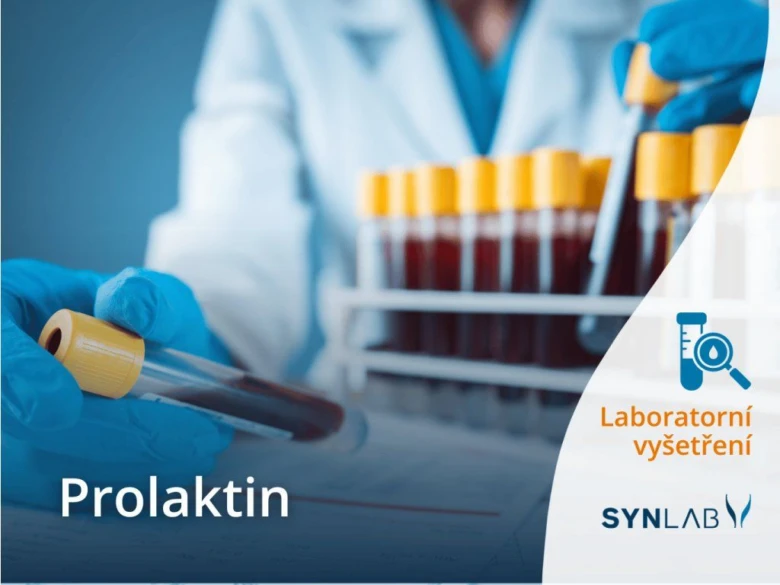 Laborant drží krevní vzorek v testovací zkumavce.