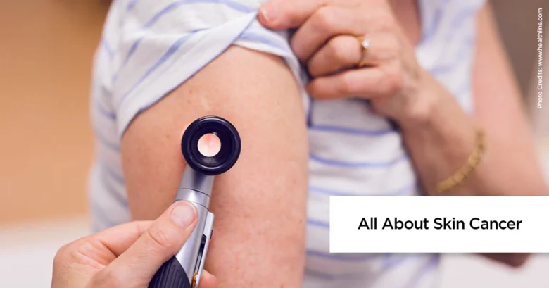Lékař zkoumá kůži pacienta pomocí dermatoskopu.