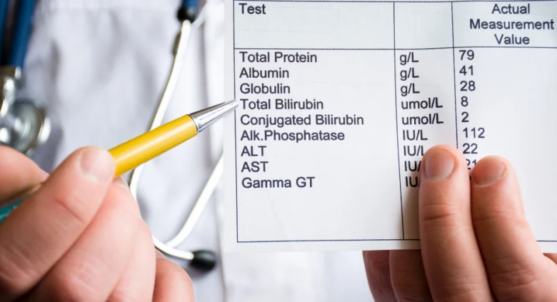 Krevní test s hodnotami bilirubinu a jiných jaterních markerů