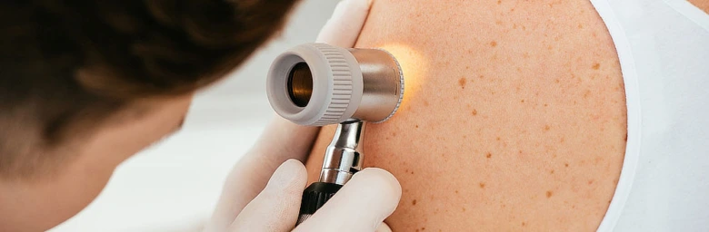 Dermatolog zkoumá skvrny na kůži pomocí derooskopu.