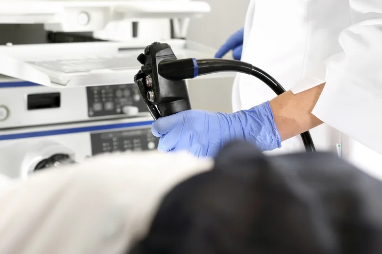 Endoskopický vyšetření žaludku pro diagnostiku vředů.
