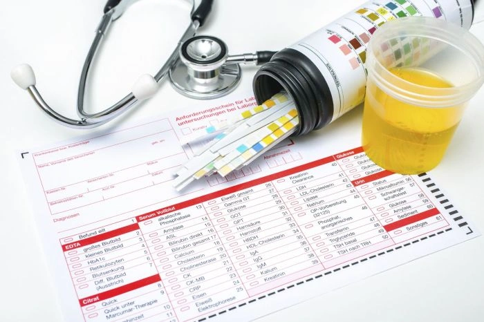 Kontejner s testovými proužky, vzorek moči a fonendoskop na lékařském formuláři.