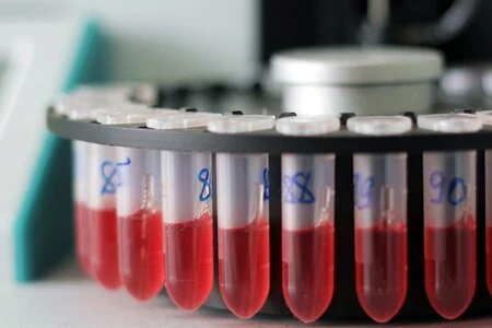 Krevní vzorky v laboratorních zkumavkách pro diagnostiku.