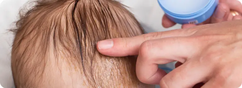 Babičce s seboroickou dermatitidou na hlavě ukazující krém.