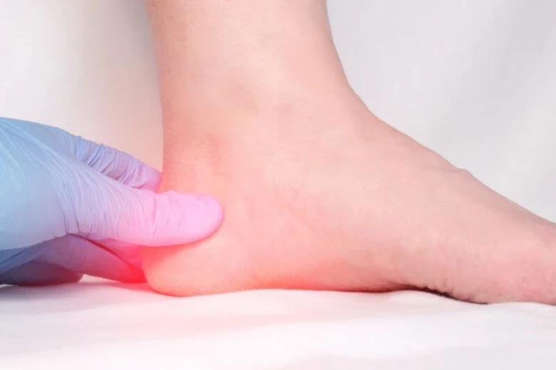 Heel pain examination