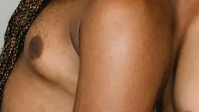 Mužská prsa s gynekomastií jako příznak pro léčbu.