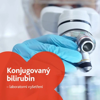 Ruka v modrých rukavicích drží mikroskop pro laboratorní vyšetření.