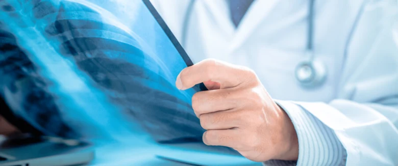 Lékař zkoumá rentgenový snímek plic při diagnostice.
