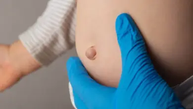 Lékař zkoumá pupočkovou kýlu u kojence v modrých rukavicích.