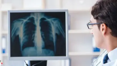 Doctor viewing chest x-ray