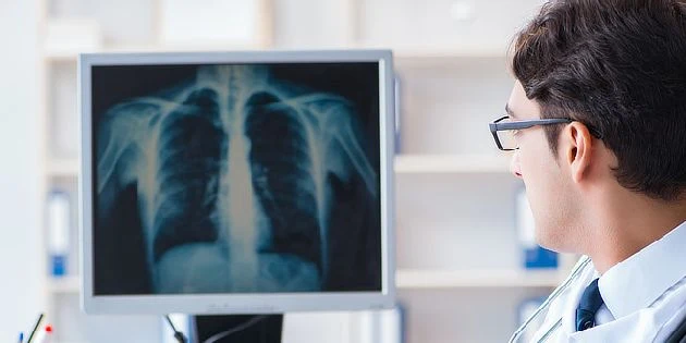 Doctor viewing chest x-ray