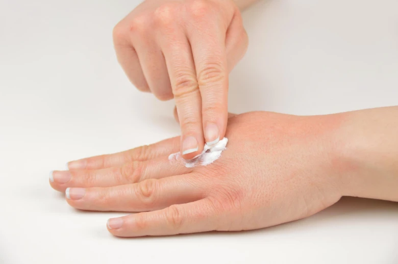 Nanosebí krém na ruku při léčbě dermatitidy.