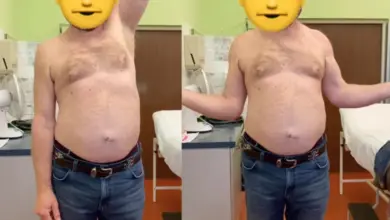 Muž v nemocničním pokoji s obličejem zakrytým emotikonou.