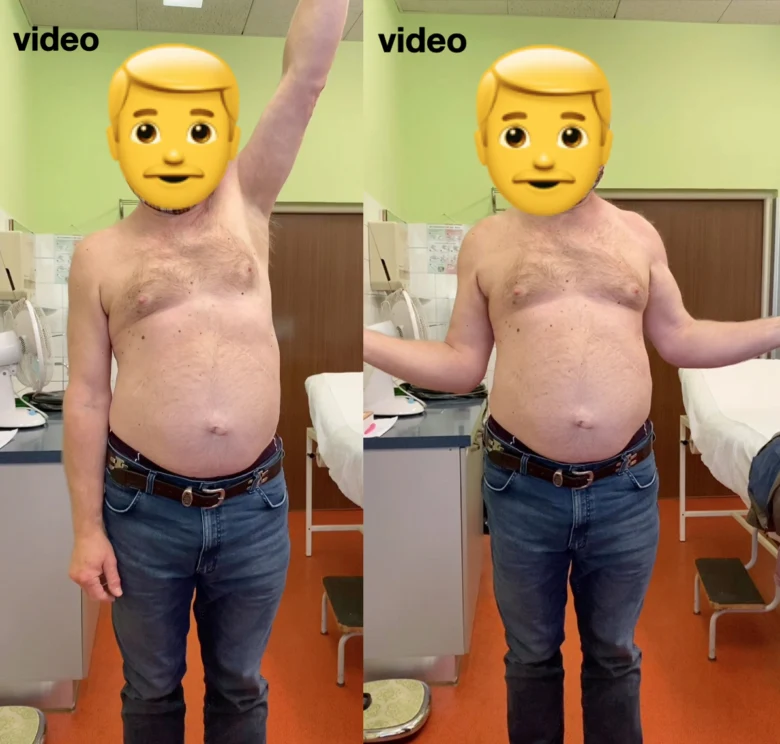 Muž v nemocničním pokoji s obličejem zakrytým emotikonou.